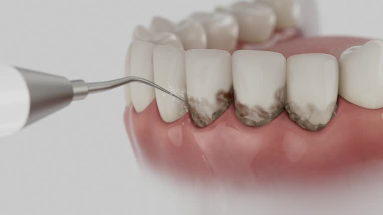 Reliable Dental Implants contractor in Meadowbrook, CA by Smile Center Dentistry